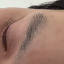 바른약품 | 일양약품 [닥터프리메틱크림] 2주 실사용후기 추천