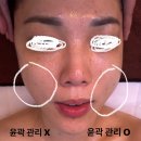 (주)브이써클메디칼 | 진해 웨딩관리 '가마지에스테틱' 다크써클 고민 해결! 1회 관리로 물광 톤업+승모근 순삭 후기