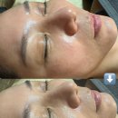 아이셀메디텍 이미지