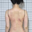 남매찻집 | 용인 등관리 올더뉴핏에서 예신 웨딩촬영 전 승모근 풀기 처인구 에스테틱