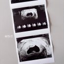 연해들 | 원포 임테기 역전 후 연해짐, 후크현상일까? 임신 확인 후기