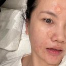 피어나피부샵 | [청량리여드름관리] 청량리역 근처 문제성 피부 전문 에스테틱 피어나뷰티 후기