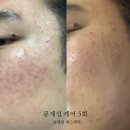 숨앤쉼에스테틱