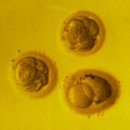 PLAY 소통가족 | 신설 마리아병원 시험관 1차 후기｜난저 진료 과정·비용·일정 총정리 (비임신 종결)