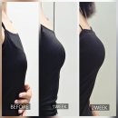 가슴마사지 고민 끝 블링붑스로 완성한 2주간의 가슴커지는법 리얼 변화 후기
