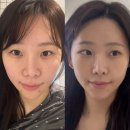 웰라인 | [반포피부관리] 웰라인페이테스에서 붓기컷 림프순환관리 받고 얼굴붓기 해결! (내돈내산)