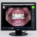 디지털올리브치과의원 | 잇몸이 찌릿할 때 인생 치과를 만났다