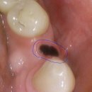 나무가있는치과의원 이미지