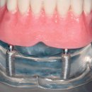 바른임플치과의원 이미지