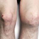 수원고려본정형외과의원 이미지