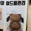 뷰티솜