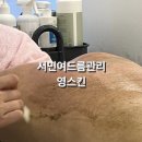영스킨샵