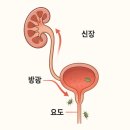 소변에서피가 계속 나오는 원인