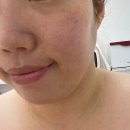 라라(RARA) | 검단피부관리 라라쌀롱, 속건조 잡아주는 MTS 관리 받은 후기