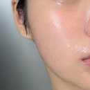 131 | 셀라딕스 131 앰플 사용 후기 및 여드름피부 변화