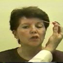 Cranial Nerve Abnormal examples - Cranial Nerve 5- Sensory 이미지