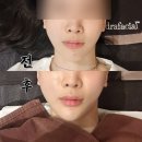 도도성형외과 - 동대문구 천호대로 425 | 예뻐지는 도도TV 병원에서 온다 리프팅 60kj 받은 후기