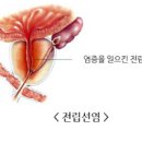 남자와 여자 아랫배 통증 원인 차이 이미지