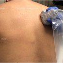 Re: 신경차단술을 위한 초음파 진단 2021 논문!! 이미지