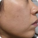 뷰티앤뷰티 | 검단피부관리 쏭앤뷰티 피부 화이트닝 관리 후기