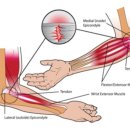 천지헬스 이미지
