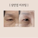 유일콜드 이미지