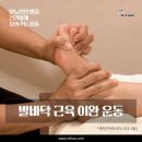 레푸스 경대점 이미지