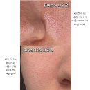 메디플렉스 | 하단 피부관리 넓은 모공관리 포어슈어로, 리빛메디스킨