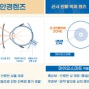 한빛안경 이미지