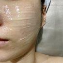 이네스뷰티테라피 | 화정동피부관리,이네스뷰티테라피 관리 후기