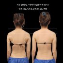 구미바디관리 : 카리테스뷰티 더조각테라피 컵테라피 후기