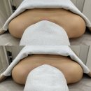 인천승모근관리 전문점 루원시티피부관리 &#34;핌에스테틱&#34; 에서 라운드숄더 펴고왔어요