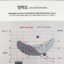 독일보청기 | 남포동보청기 전문 남포동보청기 안내 받은 독일보청기 솔직 후기