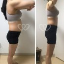 리즈뷰티엔해독센터 | 시너지디톡스 8일의기적(=기적의8일) 찐후기