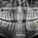 이승훈치과의원 네이버블로그
