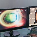 신앤박킴스안과의원 | 엄마 백내장수술/ 서면 신앤박킴스안과/내돈내산 찐 후기