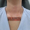 유의원 | 유올림의원 목주름 주사 효과, 후기(ft.무보정 전후 사진)