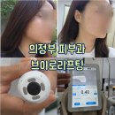 시호인테리어 - 달서구 성지로14길 10 | 의정부피부과 가성비 울써마지 브이로리프팅 받고 턱선라인 정리한 솔직 후기