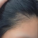 헤어 닥터맨 | 셀프 엠자 탈모 집중 관리 후기] : 브이티코스메틱 피디알엔 리들샷,닥터포헤어 세럼,탈모앰플,탈모샴푸...