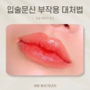 지우게장 | 입술문신하고 부작용 주의사항 통증 붓기 염증 헤르페스 수포 물집 대처법 관리방법