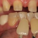 민치아치과기공소 이미지