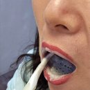 엘리트덴탈 이미지