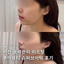 충남슈퍼 | 서산 윤곽관리 리프팅 잘하는 루아뷰티 슈퍼브이턱 후기