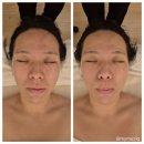 원메디케어 | 수분관리부터 목, 어깨 케어까지! 용인피부관리 메디스파 연