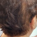 스타키보청기 안동점 이미지