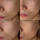 덕풍제2공영주차장 B3층 | 인천논현신부관리 더맑은스킨 인천논현점 아몬드필 하이드라부스터 V라인 트리플 관리 후기