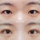 아웃라인