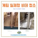 세븐일레븐 광교두산위브점 | 광교 두산위브 아파트 비데 그냥 쓰면 안 되는 이유. 계림 일체형 비데 분해청소 실제 후기