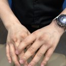 초민한의원 | [건강] 디스크환자의 내돈내산 도수치료 후기_바른몸교수