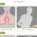 입속 피 객혈 원인 증상 토혈 목 피가래 객담 치료 이미지